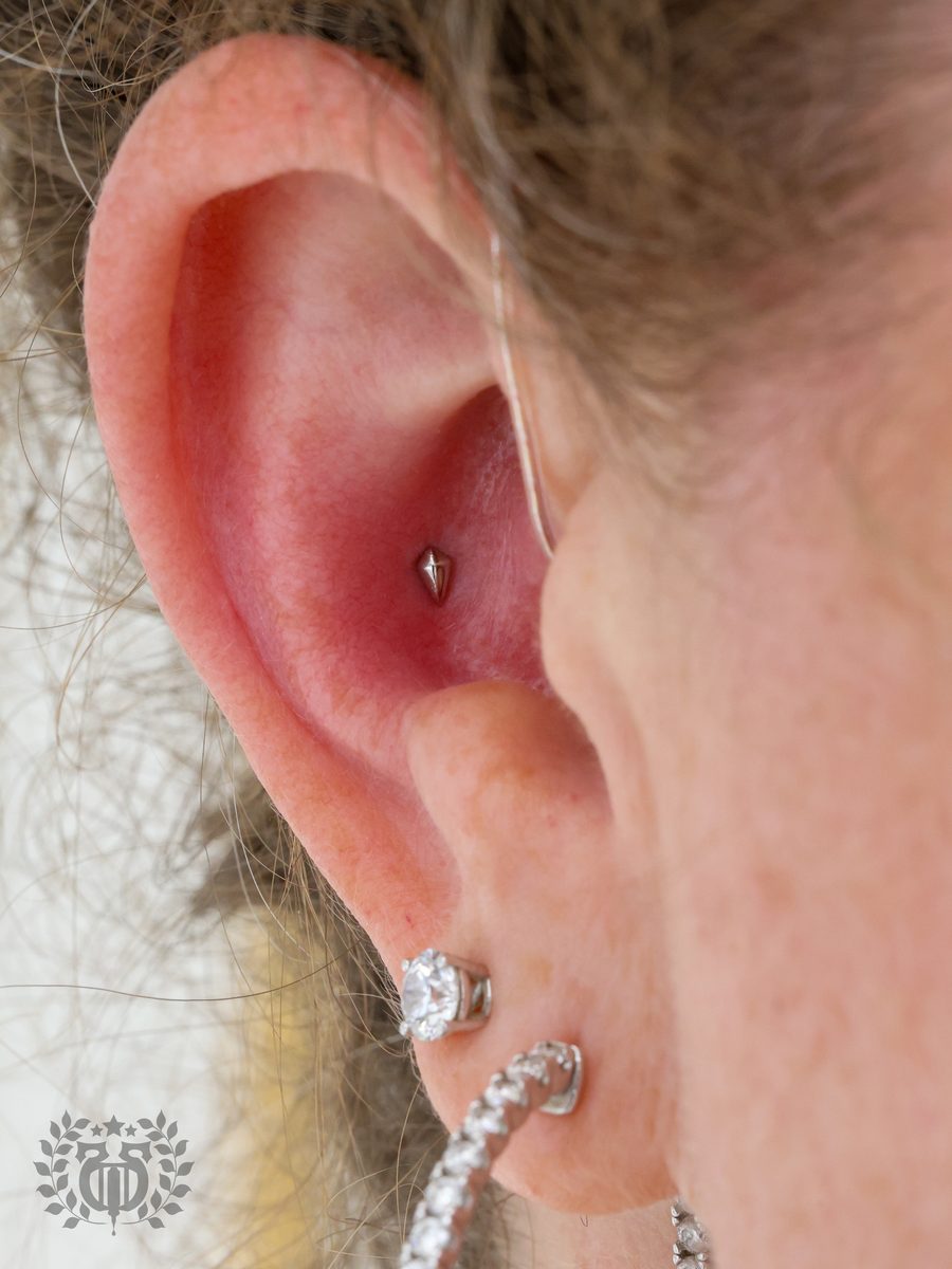Captive Bead Rings
