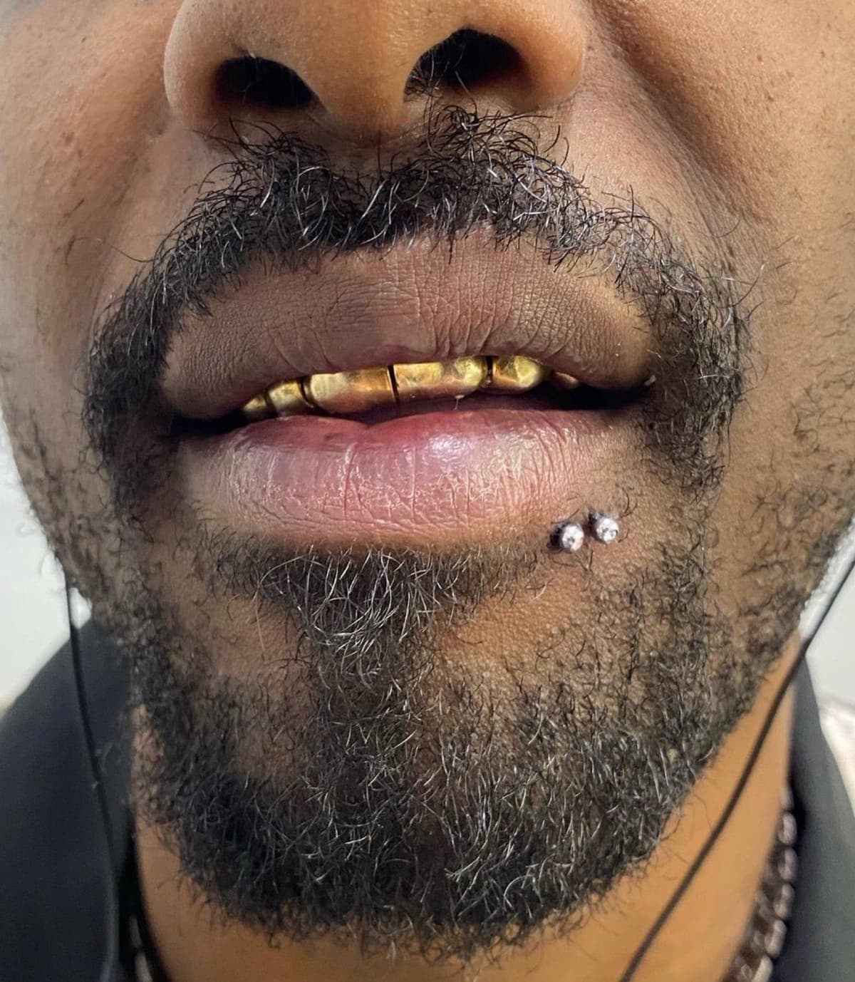 Fresh lip piercing with implant-grade titanium circular barbell close-up at Apollo Studio