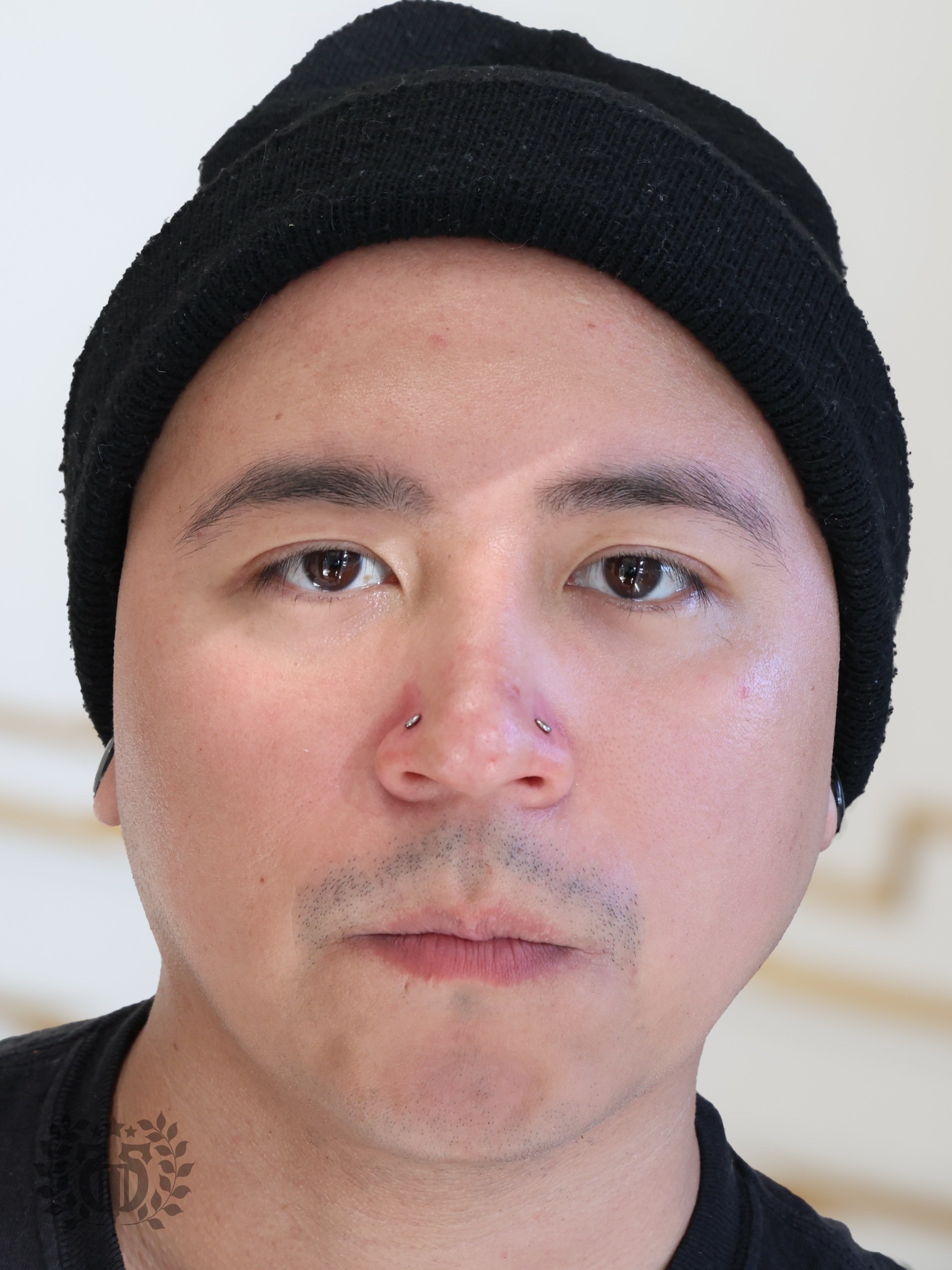Professional smiley piercing by Apollo Studio piercer in Los Angeles