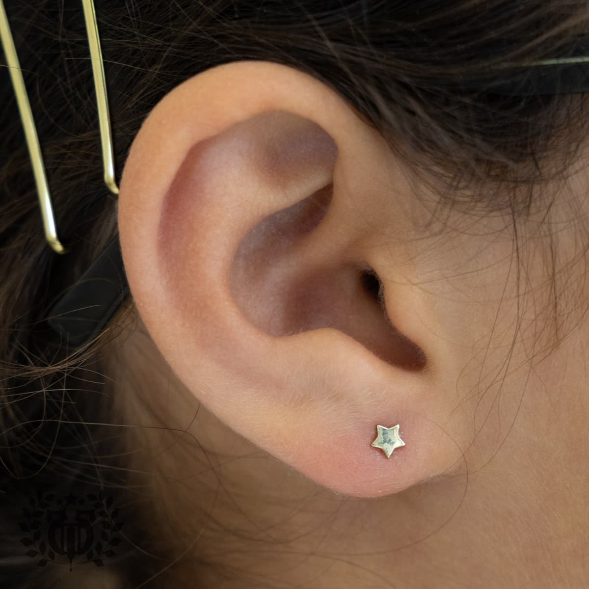 Upper Lobe, Still Not Cartilage