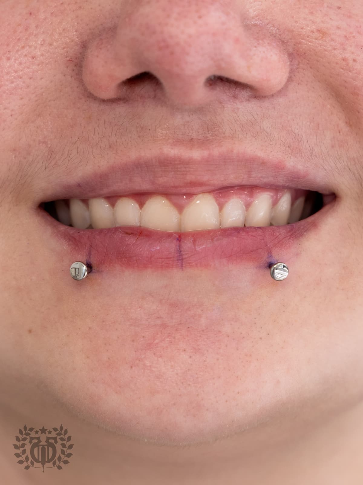 Lip & Oral